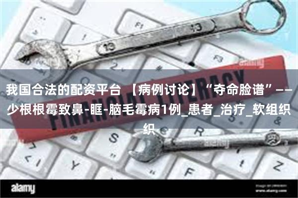 我国合法的配资平台 【病例讨论】“夺命脸谱”——少根根霉致鼻-眶-脑毛霉病1例_患者_治疗_软组织